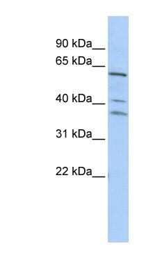 Western Blot: HIV-1 Rev binding protein Antibody [NBP1-57277]